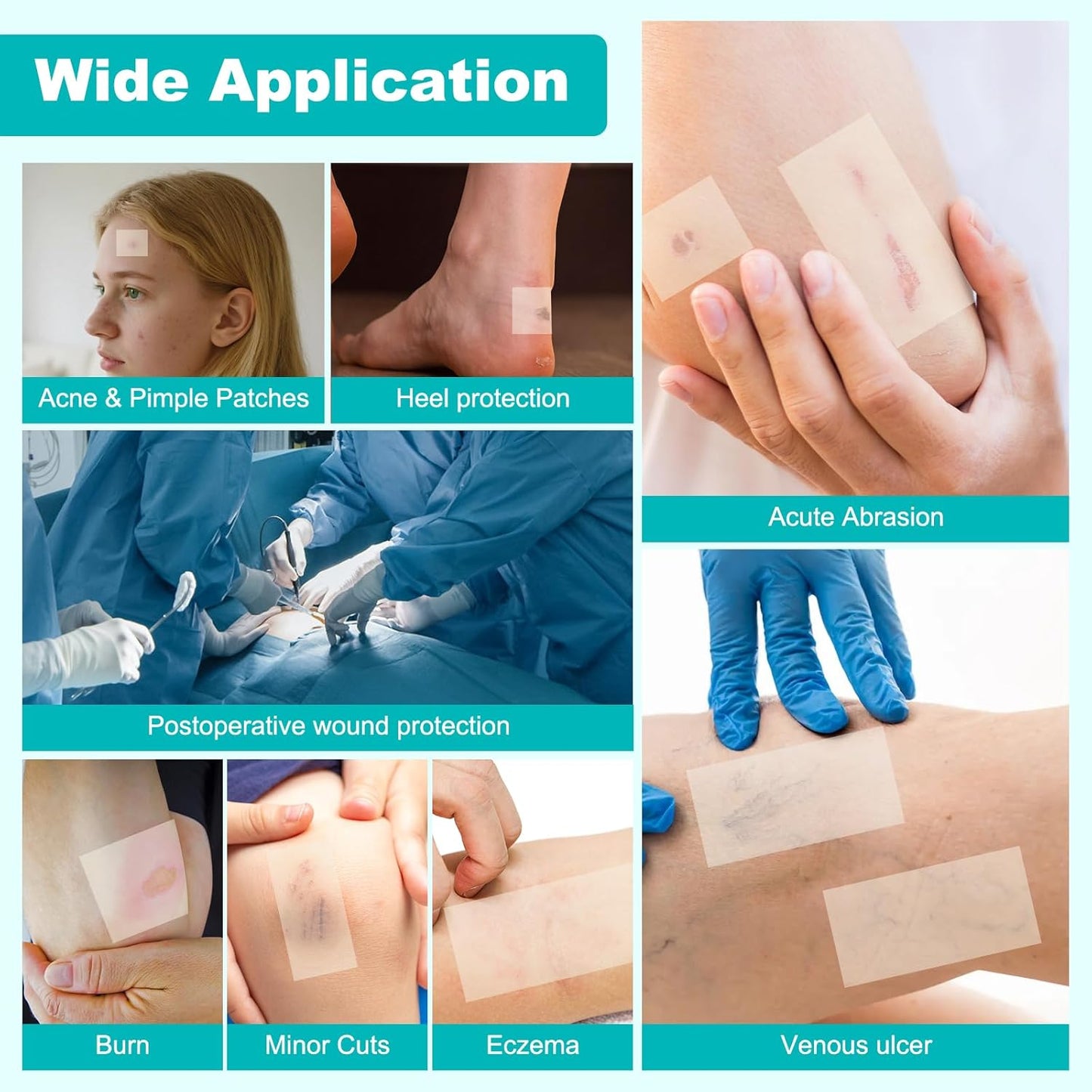 Hydrocolloid Roll Bandage — for Wounds and Skin Care